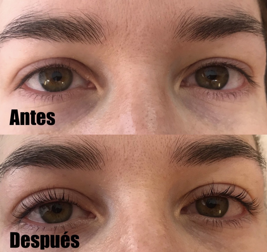 Álbumes 105+ Foto Lifting De Pestañas Antes Y Después El último